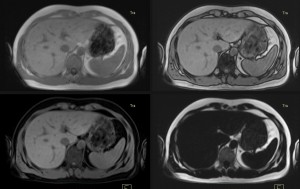 4 of 10+ filters at AIM which may be used to image liver